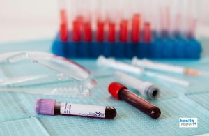 Χωρίς αποζημίωση ακόμη από τον ΕΟΠΥΥ οι βιοδείκτες για τον καρκίνο – Οι υποσχέσεις που έμειναν στο κενό