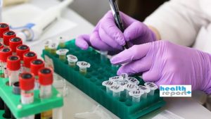 ΕΟΠΥΥ: Νέο «ψαλίδισμα» στις διαγνωστικές εξετάσεις για τους ασφαλισμένους – Ποιες μειώθηκαν